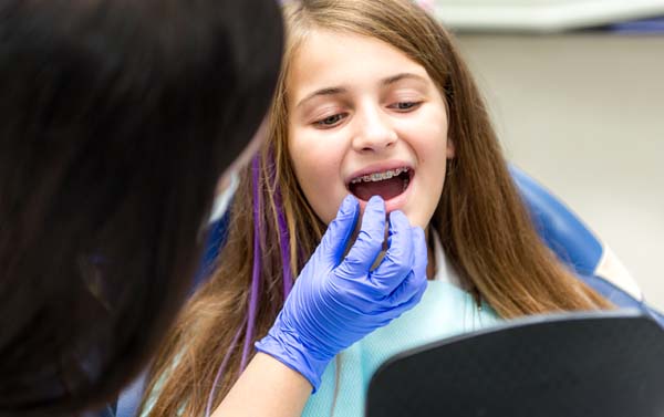 Questions To Ask Your Pediatric Dentist About Children’s Braces